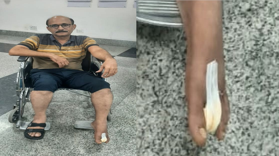 G. Siva Narayana in a wheelchair after his leg surgery, weeks before the journey to the World Memory Championship 2023